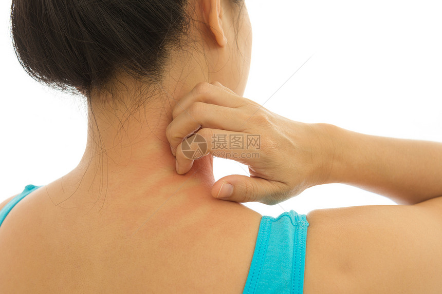 女使用手抓术时皮肤病的鲁伊红皮刺伤图片