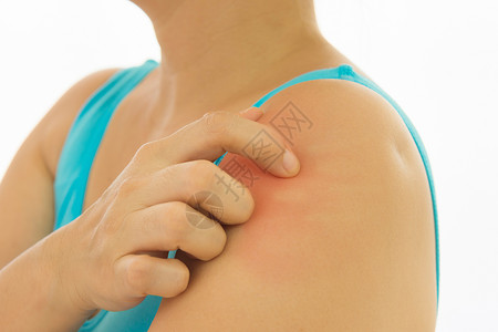女使用手抓术时皮肤病的鲁伊红皮刺伤图片