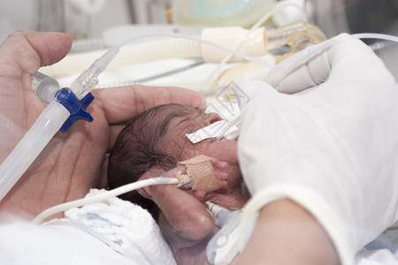 新生儿和孵化器内手掌图片