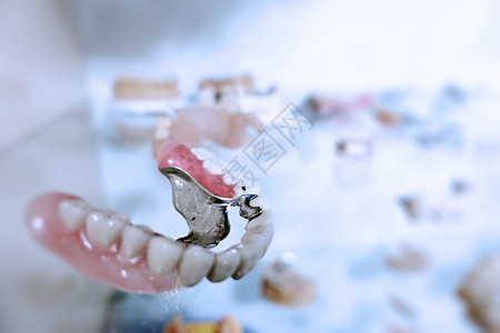 全瓷贴面牙医的牙齿瓷修复体背景