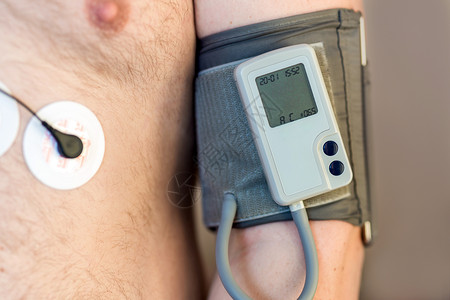 动态素材医院人体男身体上的动态心电图监测装置和每日血压记录仪每日心电图监测超重的人心脏病的高风险保背景