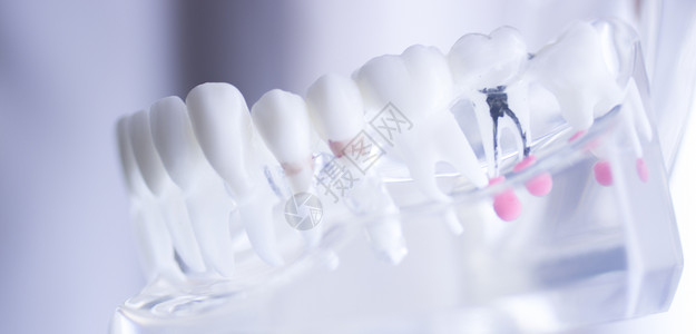 牙齿口腔牙医教学模型与牙齿牙龈图片