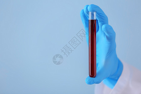 实验室工作人员持有带彩色背景血液样本的图片