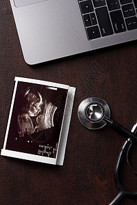 妇女怀孕主题超声波照片和听诊器放在上面图片