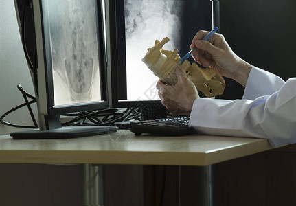 医生用笔在医务室展示人体腰脊椎模型的解图片