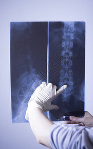 医院X射线腰痛脊柱和创伤学扫描图片
