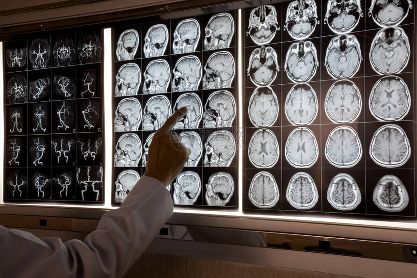 医生指向人类大脑的MRI在光图片