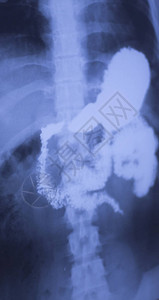 医院的X射线低背痛脊椎和外科检查也显图片