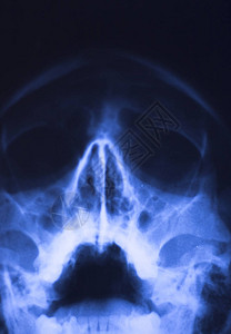 医院X光面部头骨牙齿鼻图片