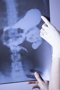 医院的X射线低背痛脊椎和臀部外科检查也显图片
