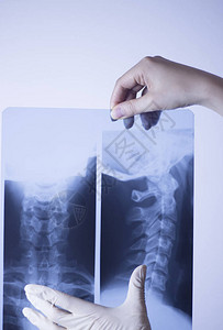 医院X射线后背疼痛脊椎和图片