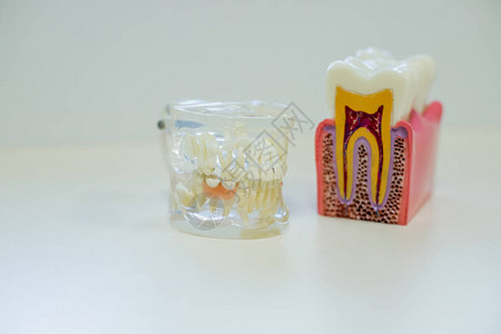 口腔健康蛀牙和糖破坏了牙釉质概念图片