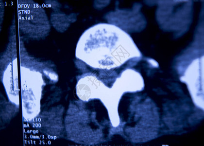 医院X射线胸骨脊椎骨盆MR图片