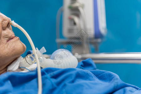 80多岁的亚洲老年女患者在医院重症监护室ICU病房的病床上使用呼吸机进行气管切开术进行背景图片
