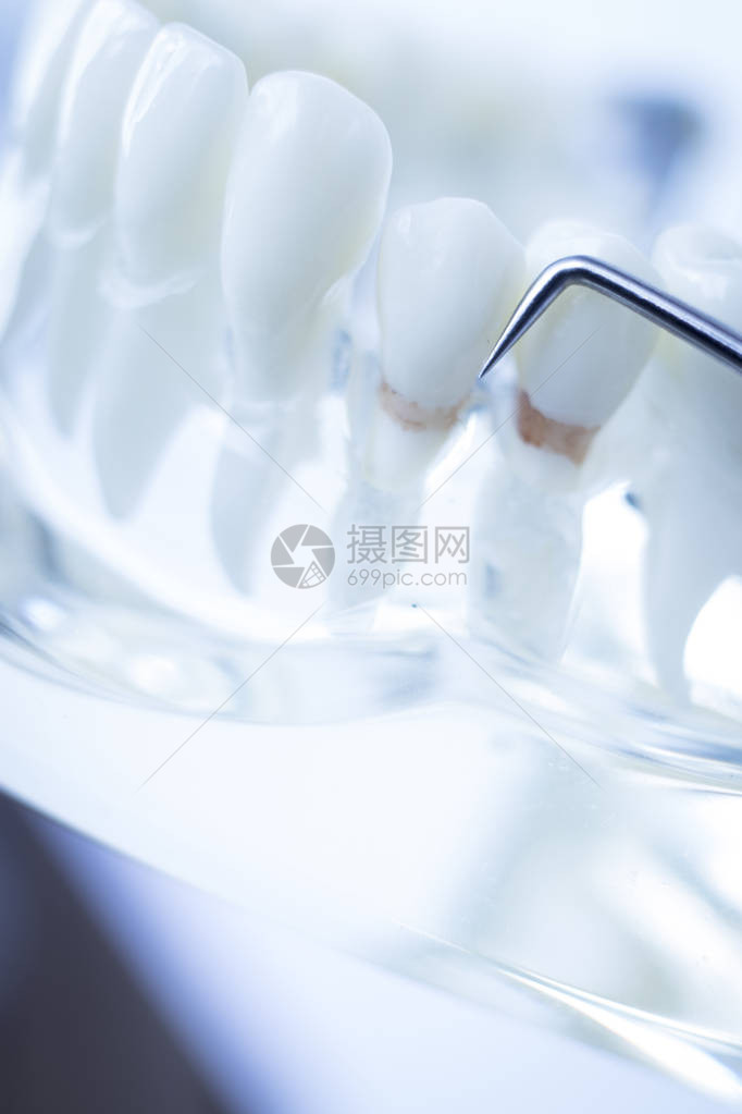 牙科医生用钛金属牙摘器清洗牙齿以除图片