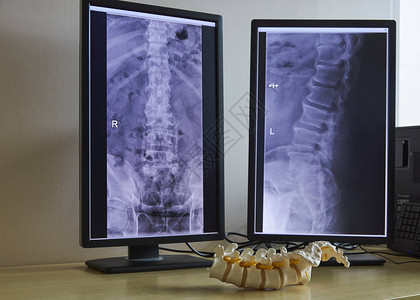 医疗办公室的人工脊椎模型图片
