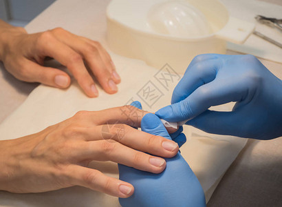 修指甲前的指甲消毒治疗角质层的切口图片