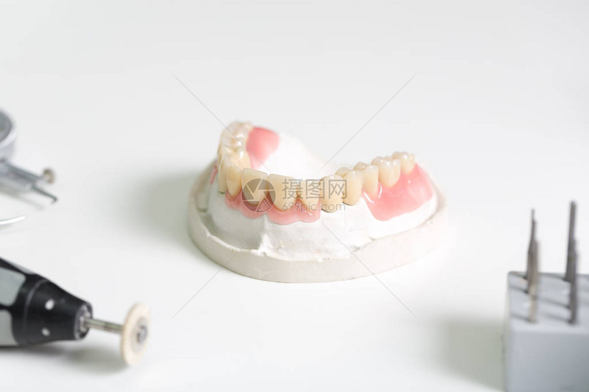 牙科化验室内人工沉积图片