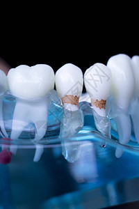 显示病人和学生每种牙和口香糖的牙科图片