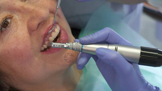 牙科卫生学家用嘴镜把病人的上唇套住图片