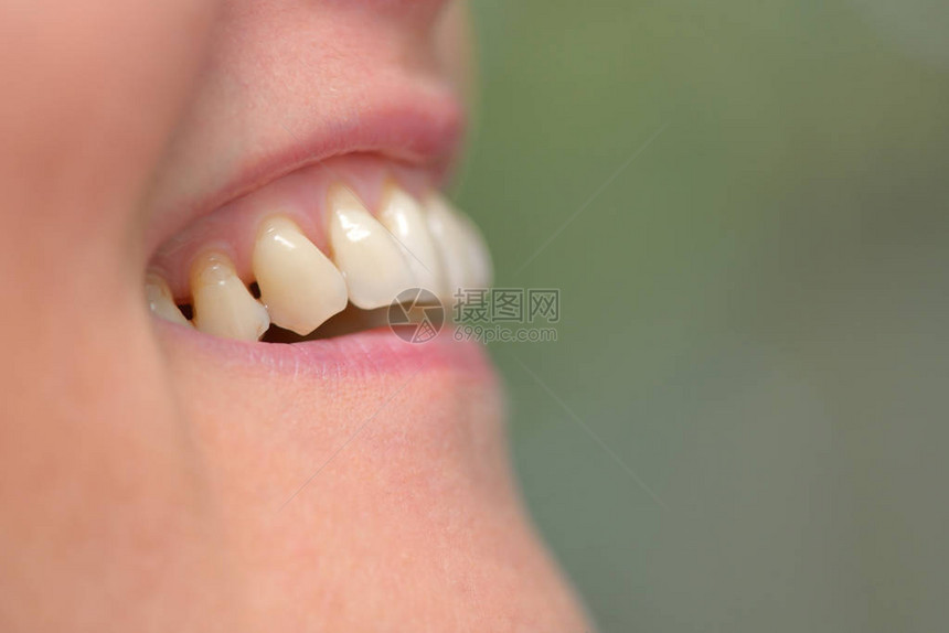 妇女牙齿口服图片