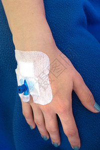 病人手与蓝色输血导管在图片