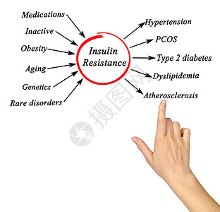 胰岛素抵抗的原因和影响图片
