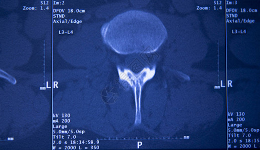 医院X射线胸骨脊椎骨盆MR图片