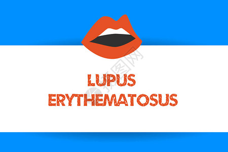 系统性LupusErythematosus商业照片显示自发免疫疾病引发的炎症背景