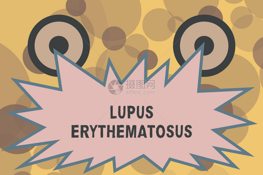 显示LupusErythematosus的文本符号由自发免疫疾病引起的图片