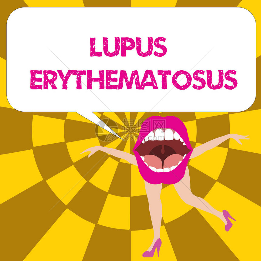 表示LupusErythematosus商业照片文本因自发免疫疾病导致的炎图片