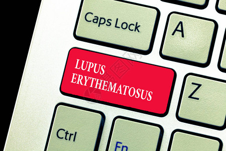LupusErythematosus概念是指由自发免疫疾病引起的图片