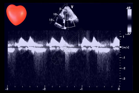 超声波图像和小心脏回声心动机屏幕图片