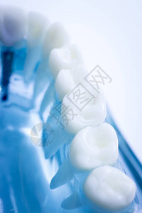 显示病人和学生每种牙和口香糖的牙科图片