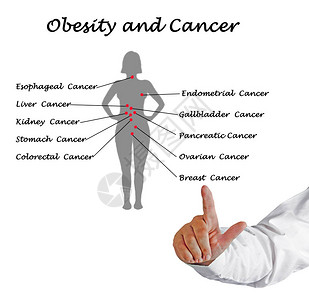 肥胖与癌症间的关系致病与癌图片