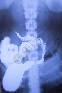 医院的X射线低背痛脊椎和外科检查也显图片