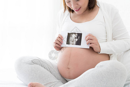 孕妇手持检查X射线图片图片