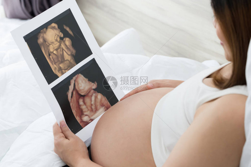 孕妇在家中拿着超声图像和医疗文件图片