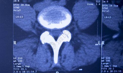 医院X射线胸骨脊椎骨盆MR图片
