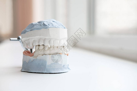 假肢实验室的牙科铸造石膏模型人类爪牙科矫形学图片