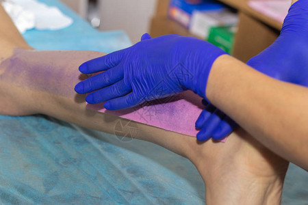 美容师在美容诊所用蜡条给女人的腿打蜡图片