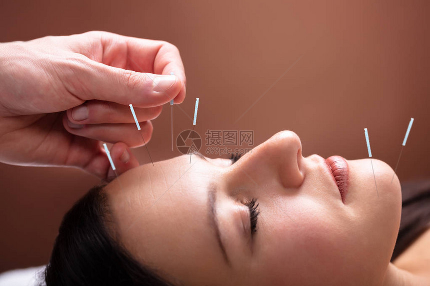 女面部接受针缝孔治疗的近亲在S图片