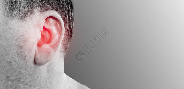 耳炎听力损失男症状背景