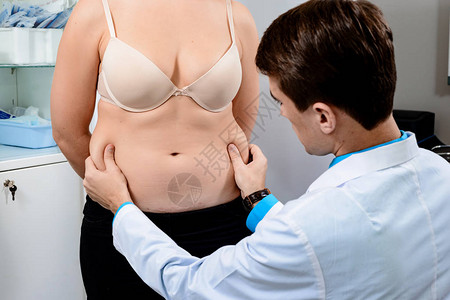 外科医生的实际咨询以去除腹部多余的脂肪抽脂手术前图片