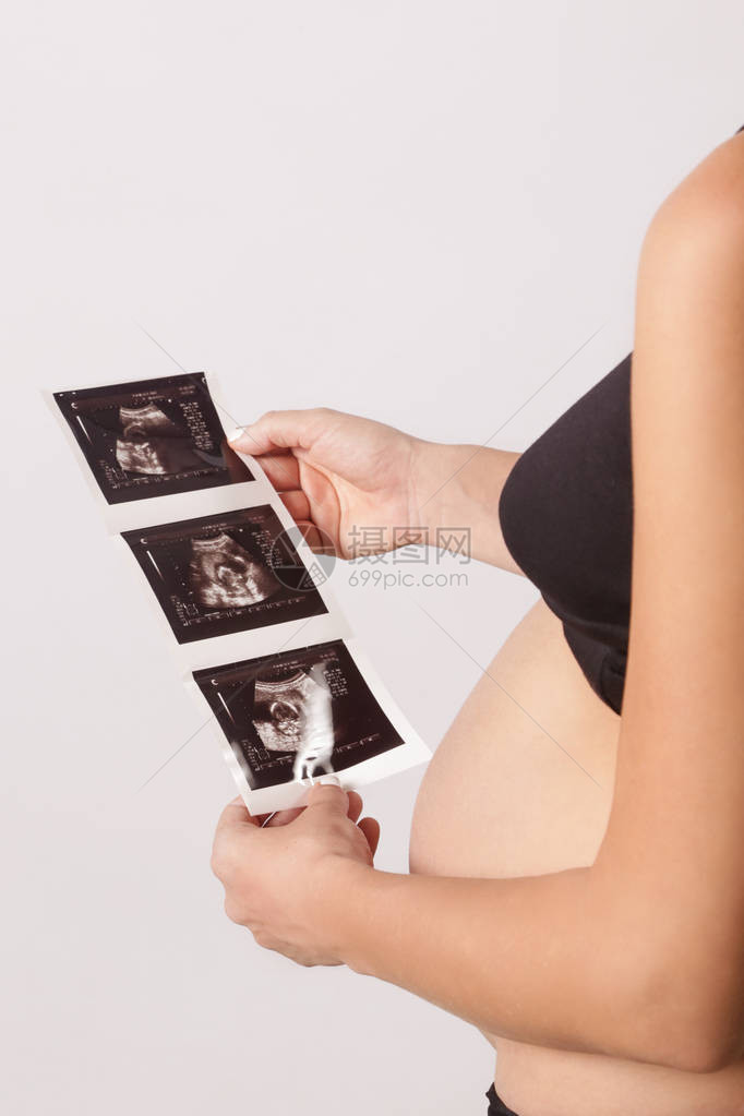 拿着超声波扫描的孕妇图片