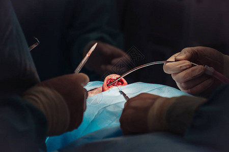 外科医生和他的助手在医院手术室的鼻子上做整容手术图片