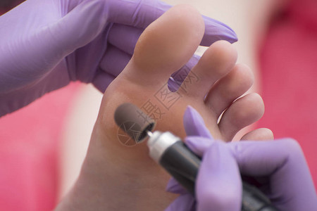脚的皮肤处理过程用修脚机手图片