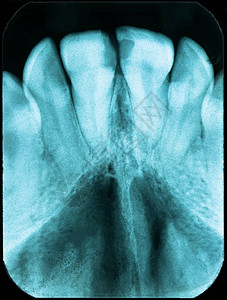 牙齿状况不良的旧图片