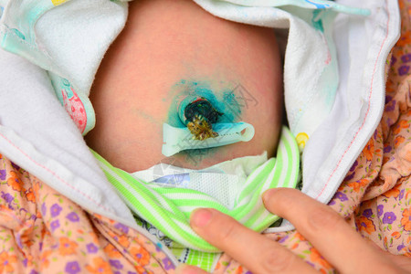 新生婴儿的身影用绿色涂料治图片