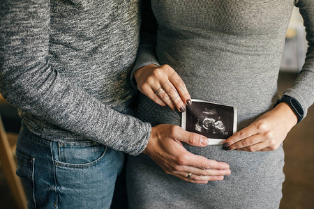 时尚的怀孕夫妇在婴儿肿块上对婴儿进行超声波扫描图片